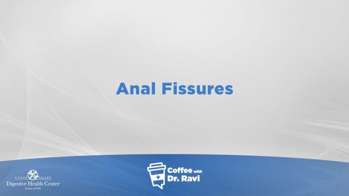 Coffee with Dr. Ravi #68: Anal Fissure Causes and Treatments